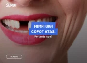 Arti Mimpi Copot Gigi Atas Menurut Islam: Apa Maknanya dalam Kehidupan dan Kesehatan?