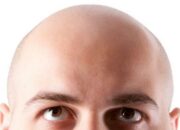 Arti Mimpi Alis Botak Menurut Islam: Pertanda Kehilangan atau Perubahan?